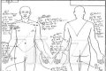 King Von Autopsy Report: Graphic Photos And Details